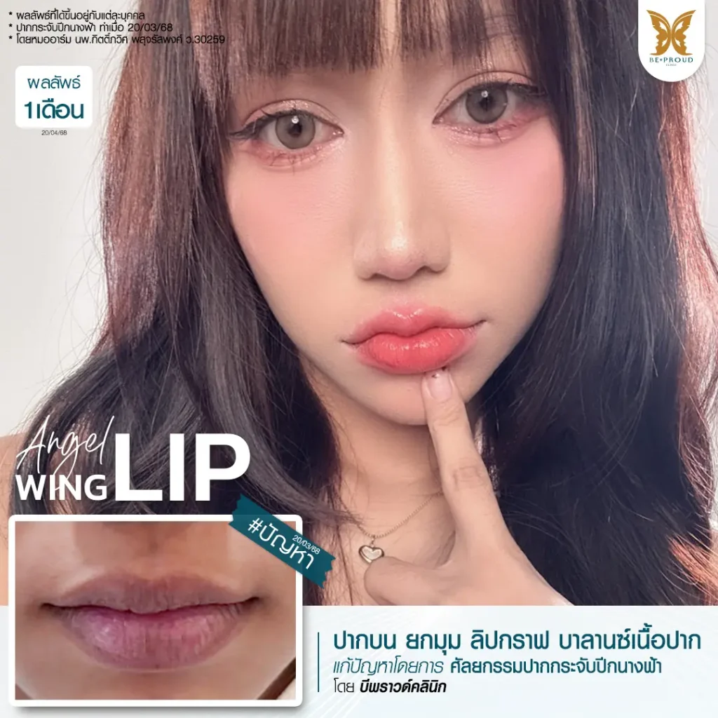 อัปเดต 2025! ปากกระจับ ราคาเท่าไหร่? เจาะลึกทุกเรื่องที่ BEPROUD Clinic ปากกระจับ ราคา อัปเดต 2025! ปากกระจับ ราคาเท่าไหร่? เจาะลึกทุกเรื่องที่ BEPROUD Clinic