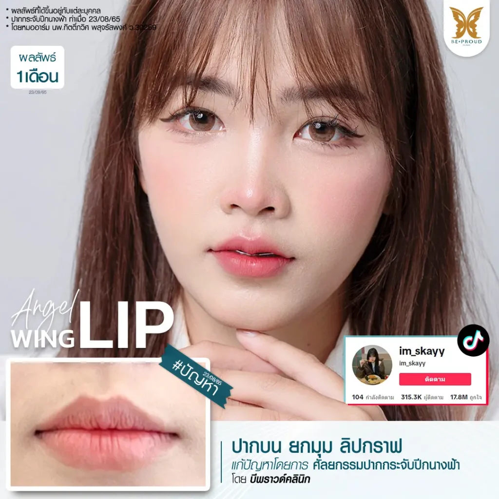 อัปเดต 2025! ปากกระจับ ราคาเท่าไหร่? เจาะลึกทุกเรื่องที่ BEPROUD Clinic ปากกระจับ ราคา อัปเดต 2025! ปากกระจับ ราคาเท่าไหร่? เจาะลึกทุกเรื่องที่ BEPROUD Clinic