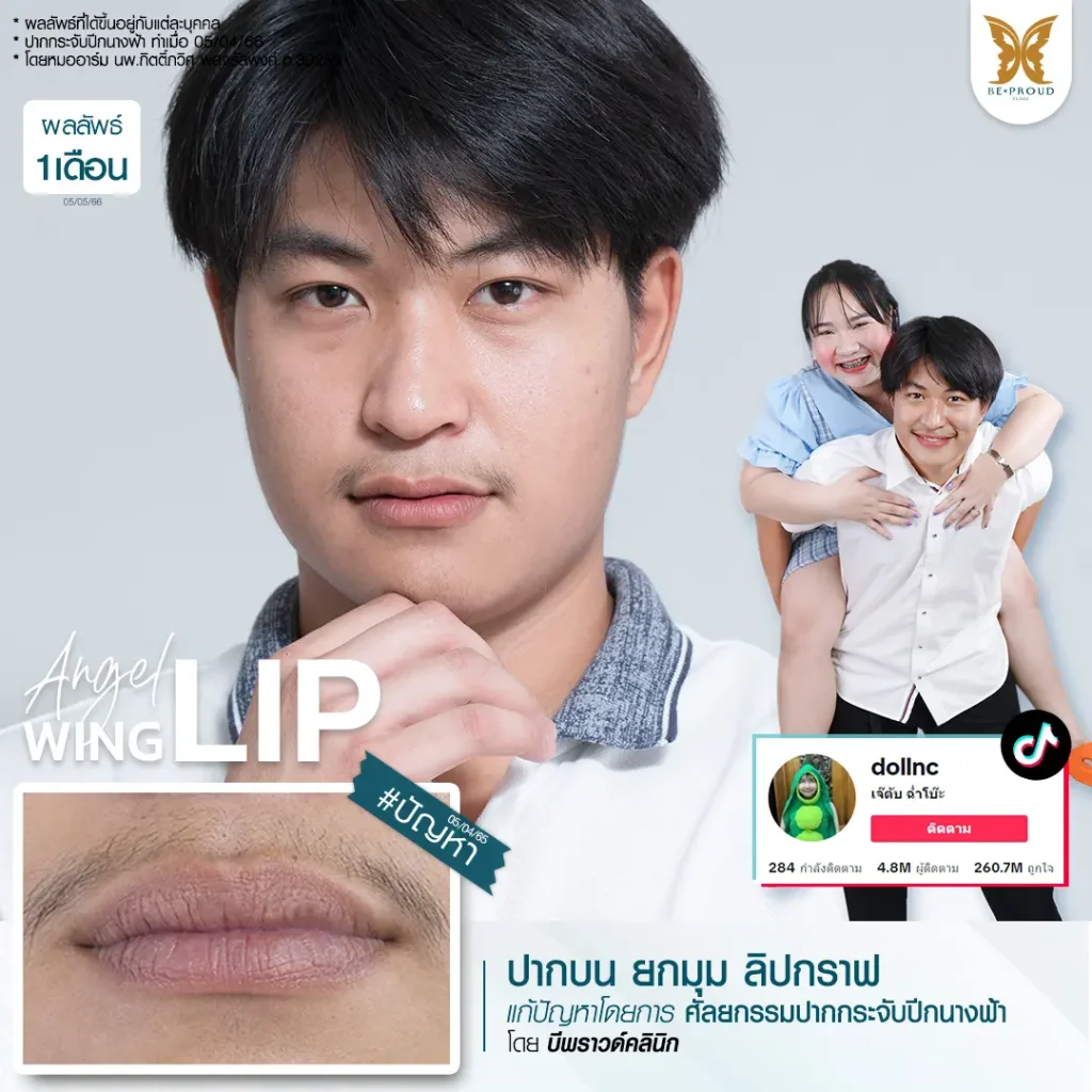 อัปเดต 2025! ปากกระจับ ราคาเท่าไหร่? เจาะลึกทุกเรื่องที่ BEPROUD Clinic ปากกระจับ ราคา อัปเดต 2025! ปากกระจับ ราคาเท่าไหร่? เจาะลึกทุกเรื่องที่ BEPROUD Clinic