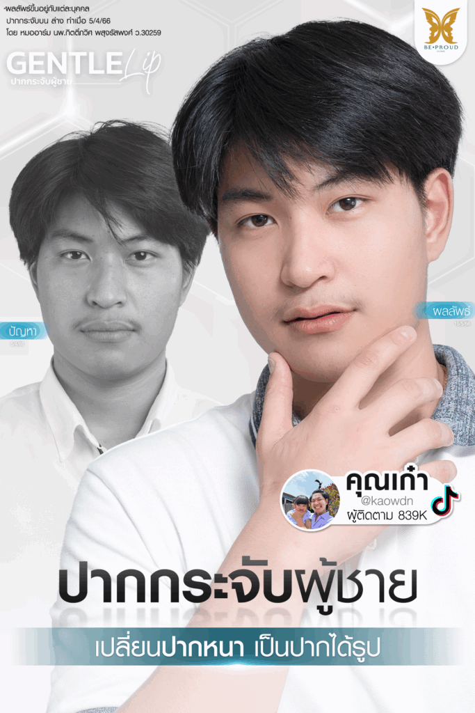 อัปเดต 2025! ปากกระจับ ราคาเท่าไหร่? เจาะลึกทุกเรื่องที่ BEPROUD Clinic ปากกระจับ ราคา อัปเดต 2025! ปากกระจับ ราคาเท่าไหร่? เจาะลึกทุกเรื่องที่ BEPROUD Clinic