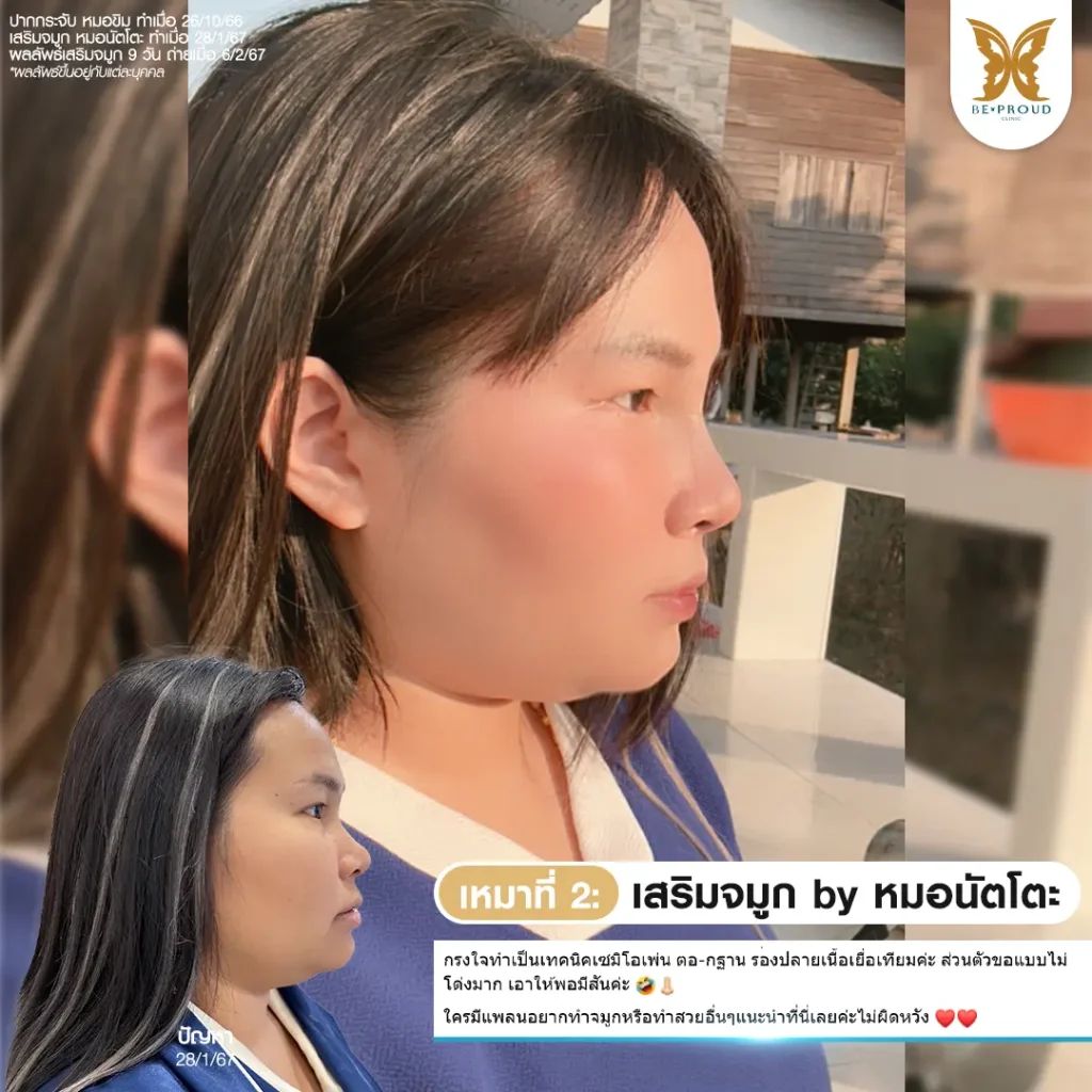 กรงใจที่แปลว่าตรงใจ ยกเครื่องหน้าใหม่ที่บีพราวด์คลินิก หน้าใหม่ กรงใจที่แปลว่าตรงใจ ยกเครื่องหน้าใหม่ที่บีพราวด์คลินิก