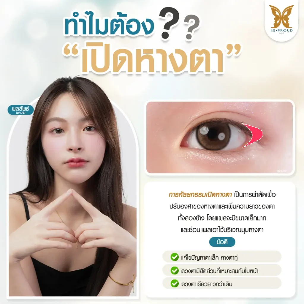 รีวิวเปิดหางตา กดตาล่าง ให้ตากลมแบ๊ว ฉบับทำที่ไทย เปิดหางตา กดตาล่าง รีวิวเปิดหางตา กดตาล่าง ให้ตากลมแบ๊ว ฉบับทำที่ไทย
