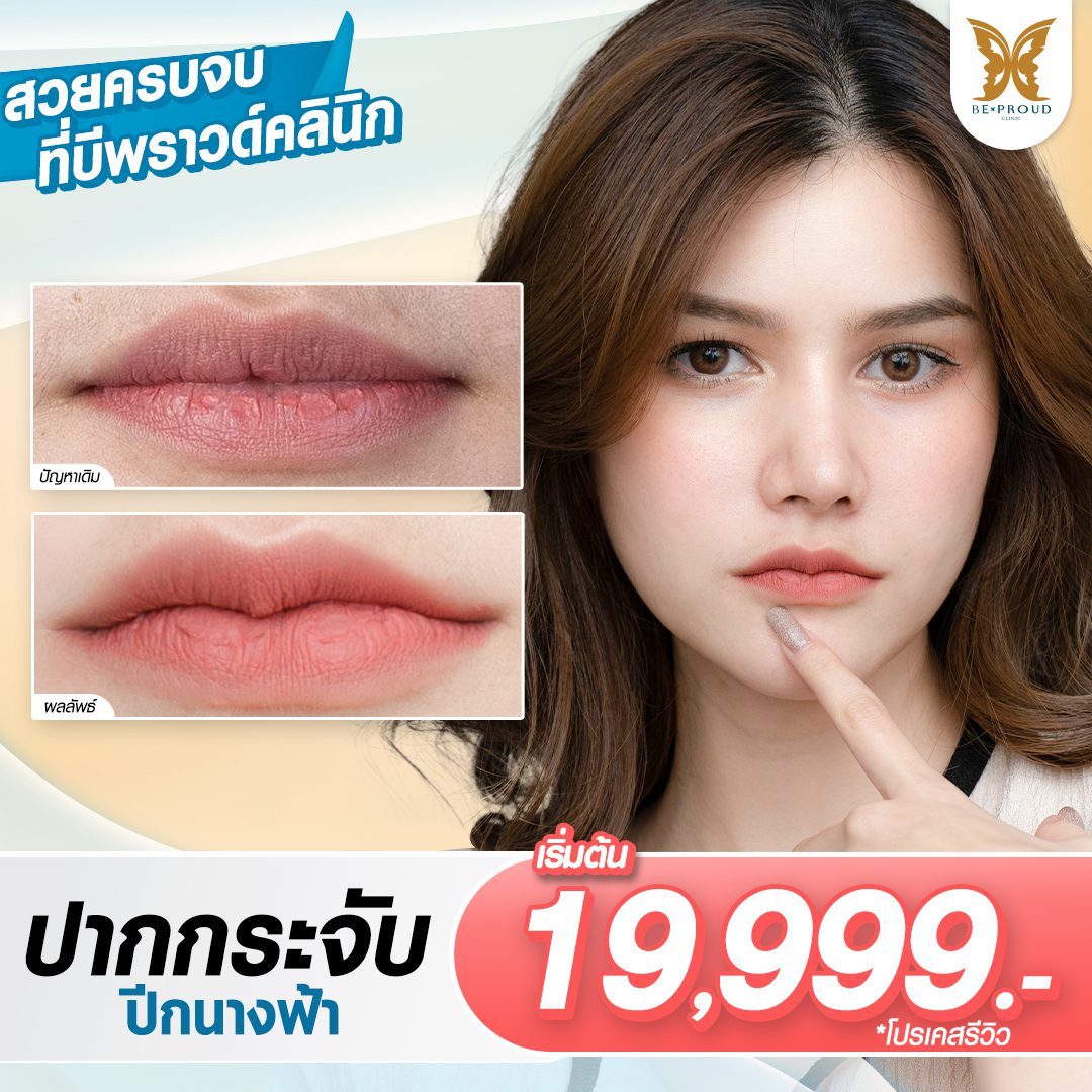 โปรโมชั่น_ปากกระจับ โปรโมชั่น_ปากกระจับ