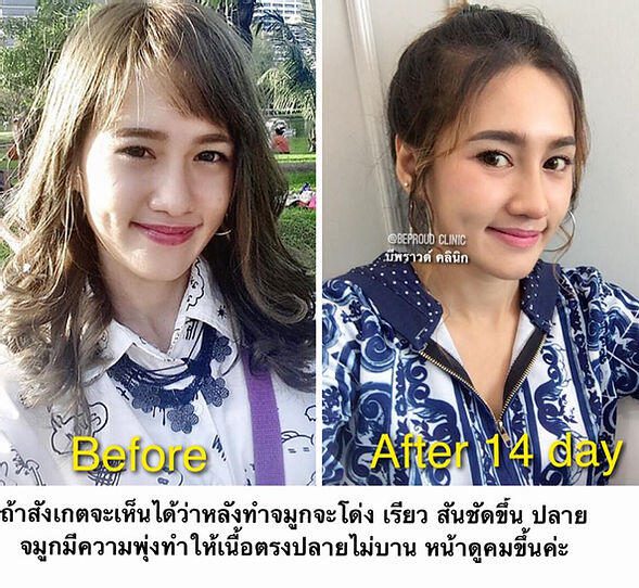 beb914_2155927782c344cb82c2bd857894f22a_mv2