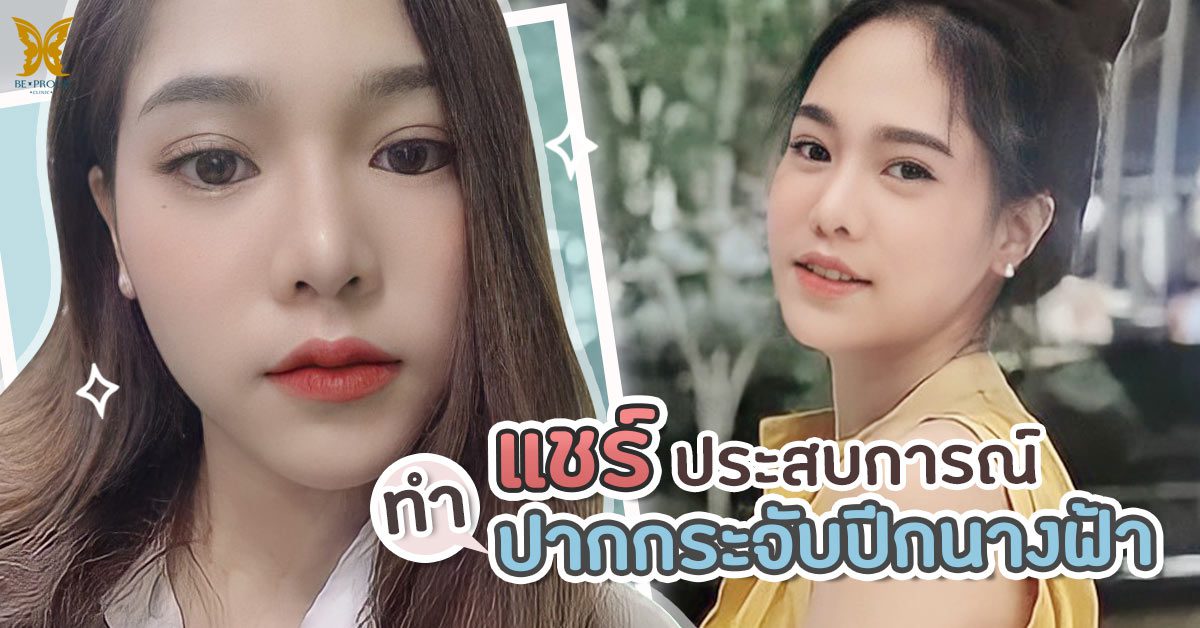 ปากกระจับ ปากกระจับ