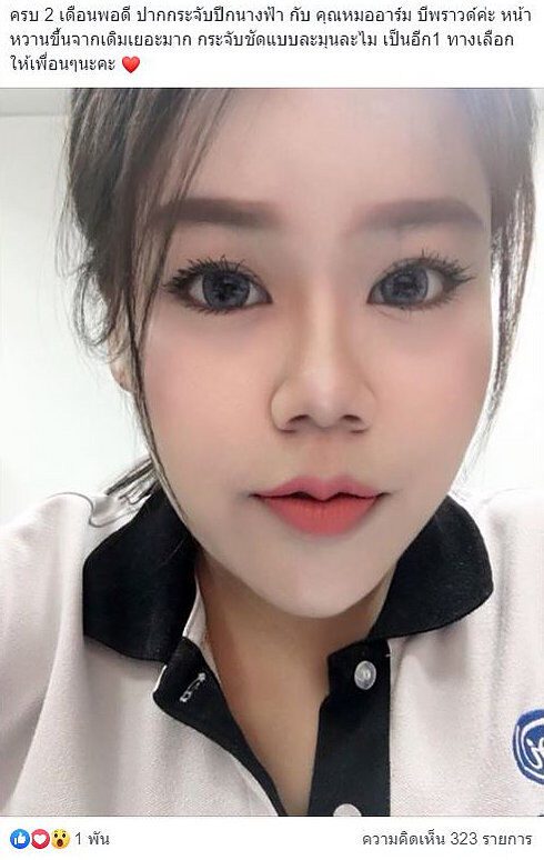 fggrtrt_edited ปากกระจับ รีวิวปากกระจับ ปากกระจับปีกนางฟ้า