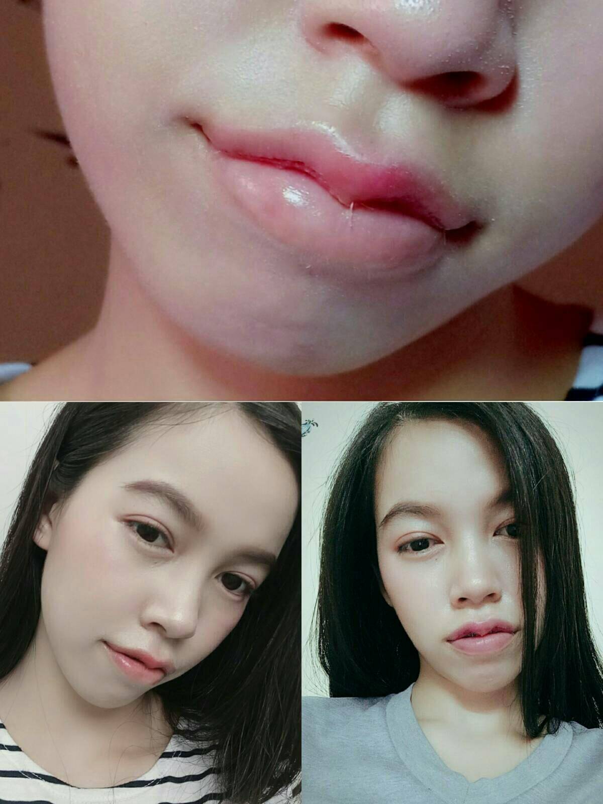 pinj6wqxyih8T0LemLy-o ปากกระจับ รีวิวปากกระจับ ปากกระจับปีกนางฟ้า