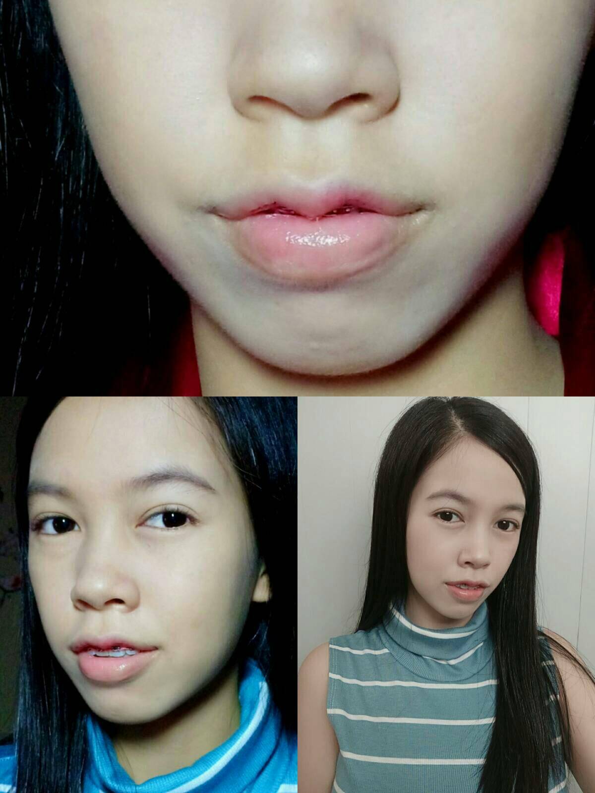 pinjq1xljOpshF008G8-o