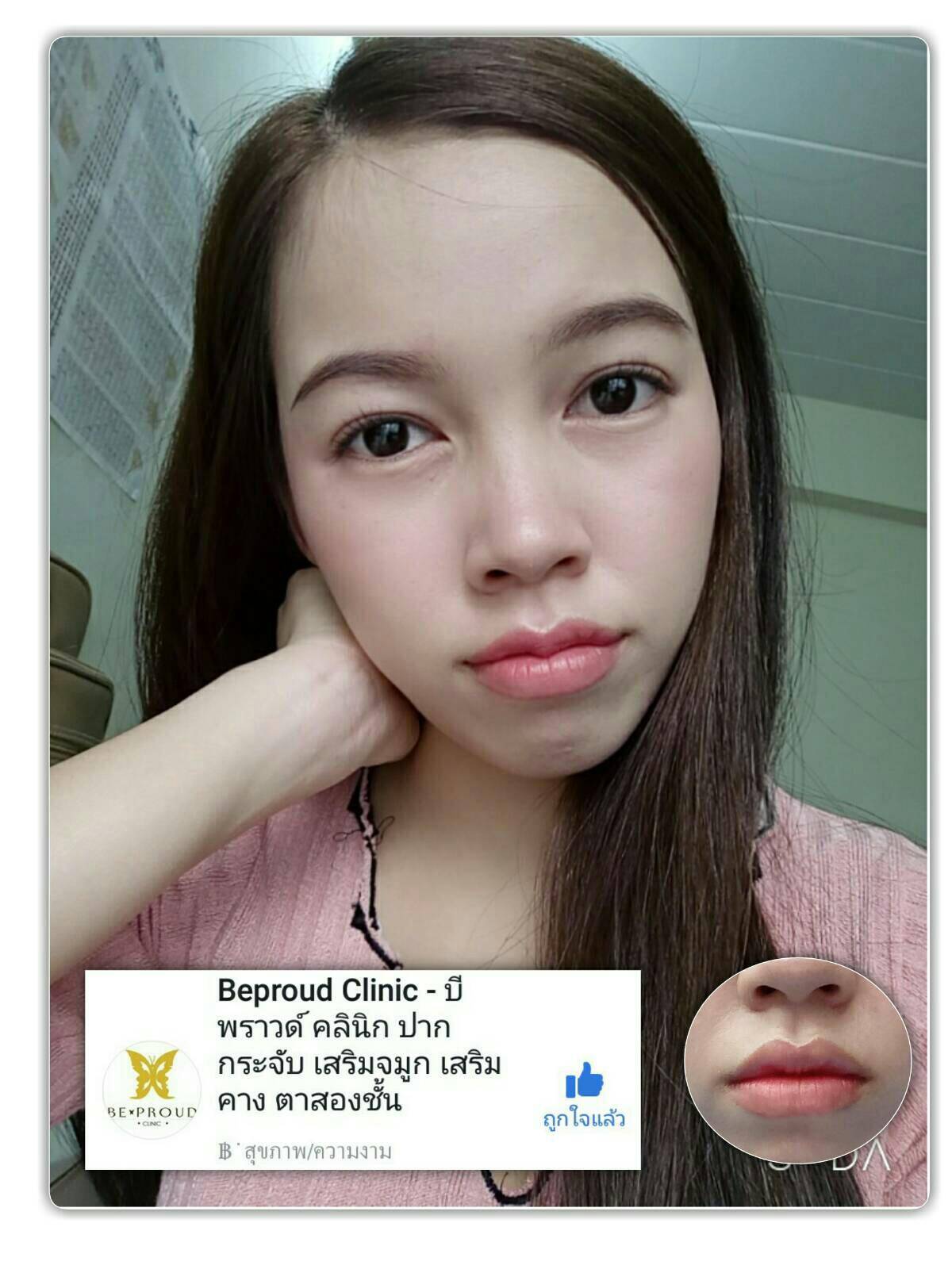 pkf1rc799Os4RYW5aA0-o รีวิวปากกระจับ น้อง