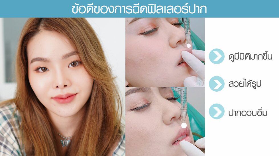 ข้อดีฟิลปาก