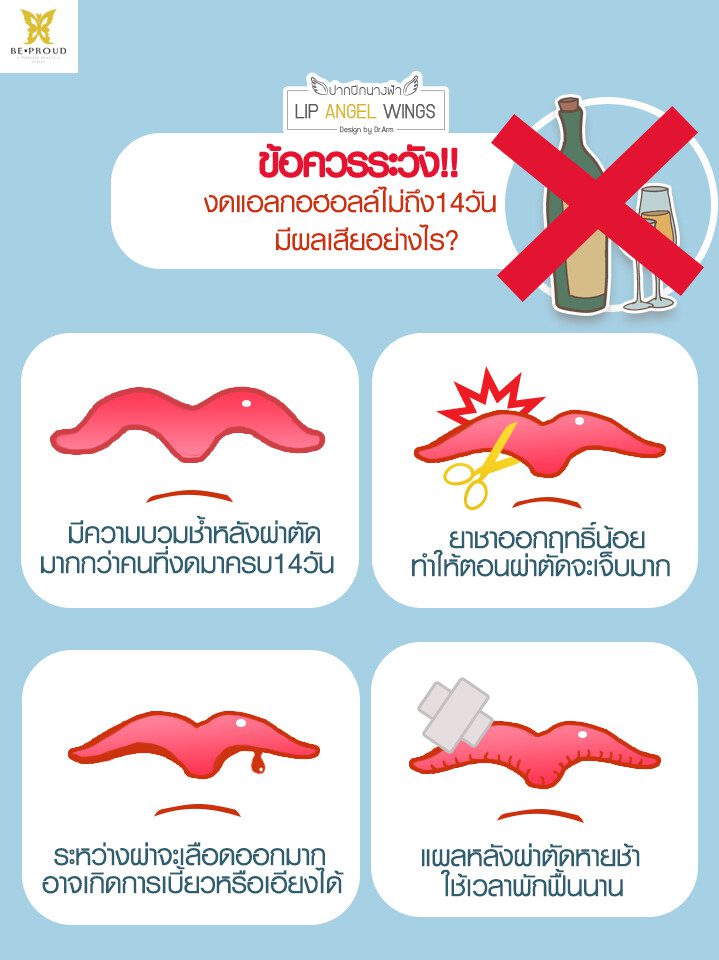 งดแอล2