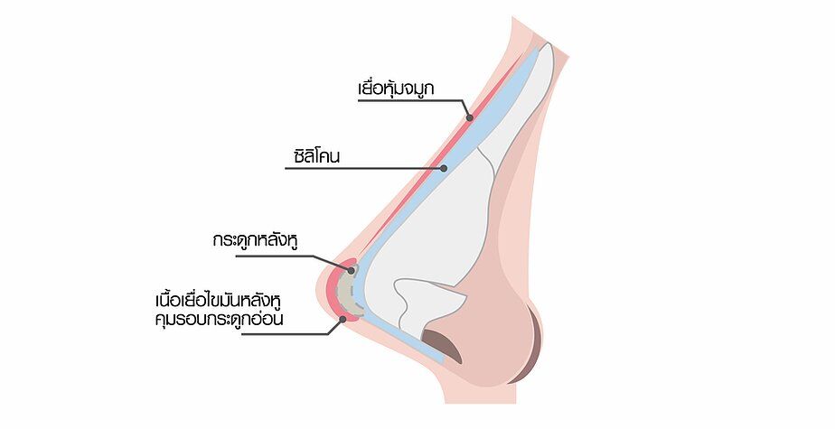 จมูกหลังหู3-01