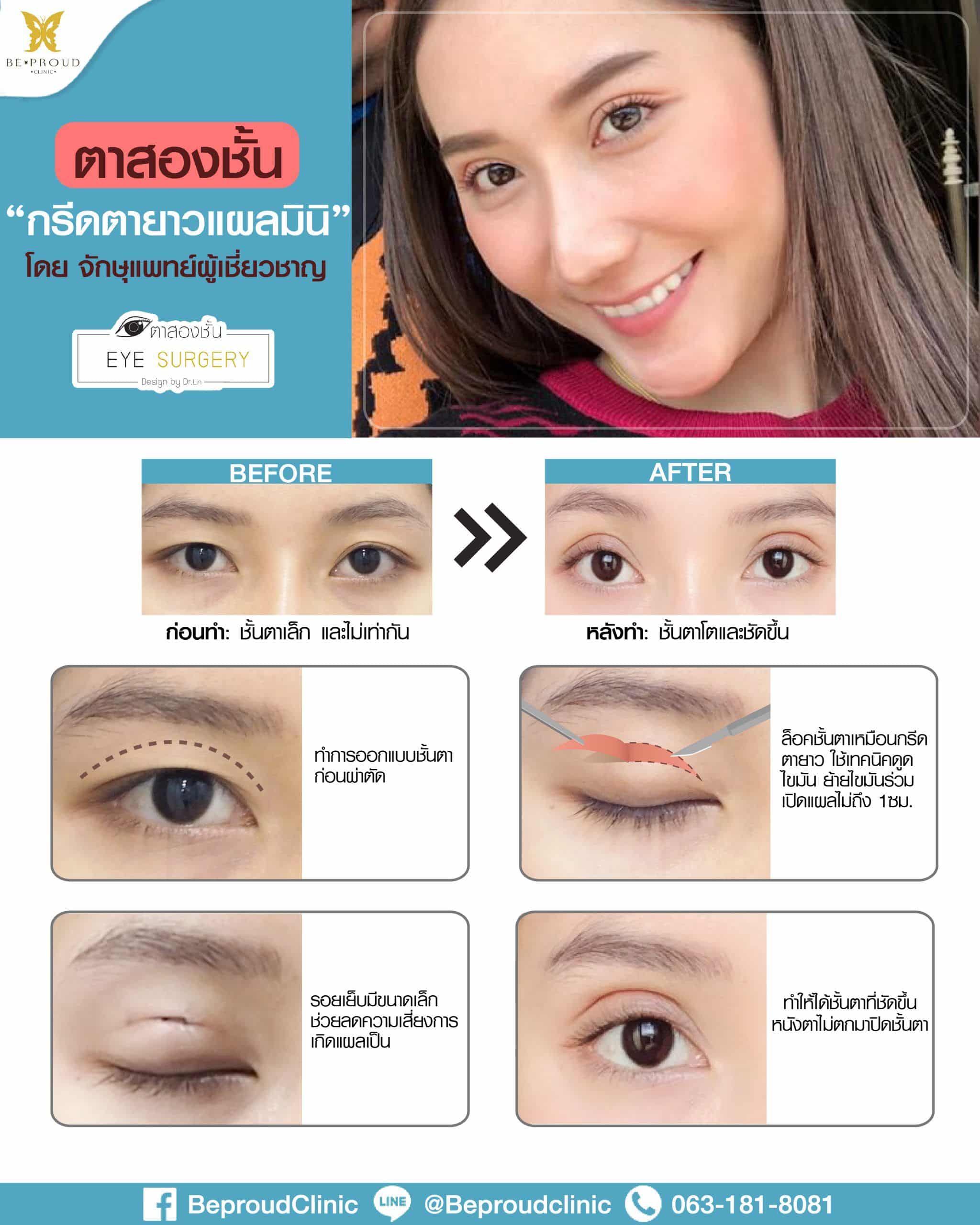 ตาkกิ๊ก-2-01