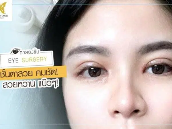 ตาสองชั้นสวยแบ๊ว