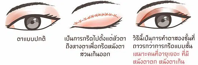 ตาสองชั้นยาวlayout