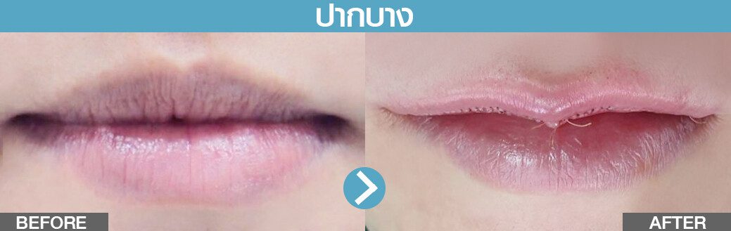 ปากบาง2 รีวิวปากกระจับ ปางบาง