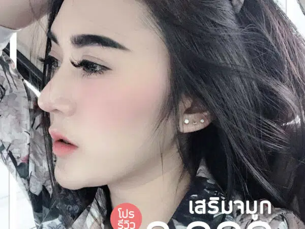 เสริมจมูก 8999