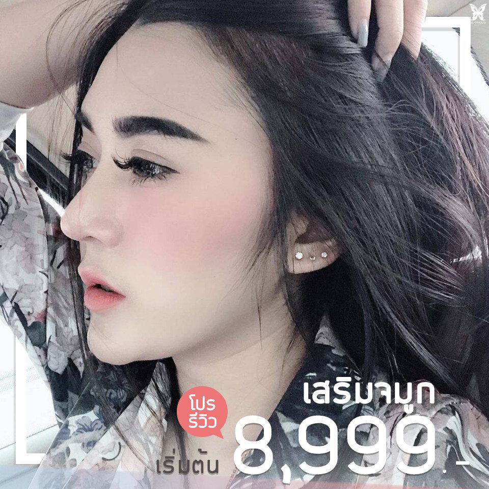 เสริมจมูก 8999