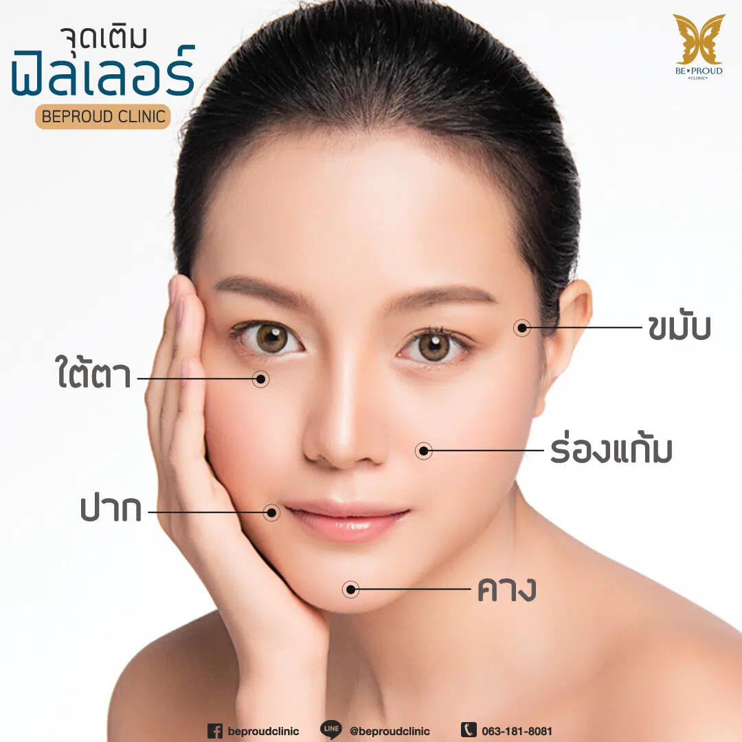 จุดเติมฟิลเลอร์ จุดเติมฟิลเลอร์