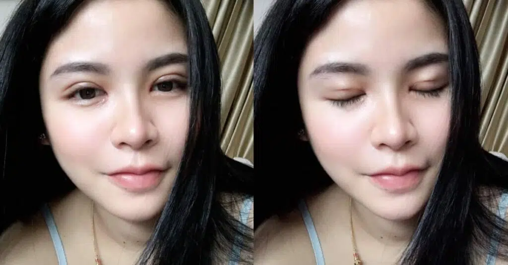 ตาสองชั้นสายเกา
