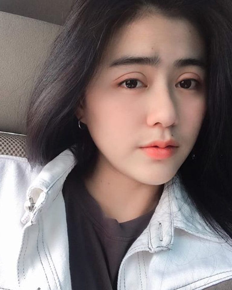 3month ปากคาง3เดือน