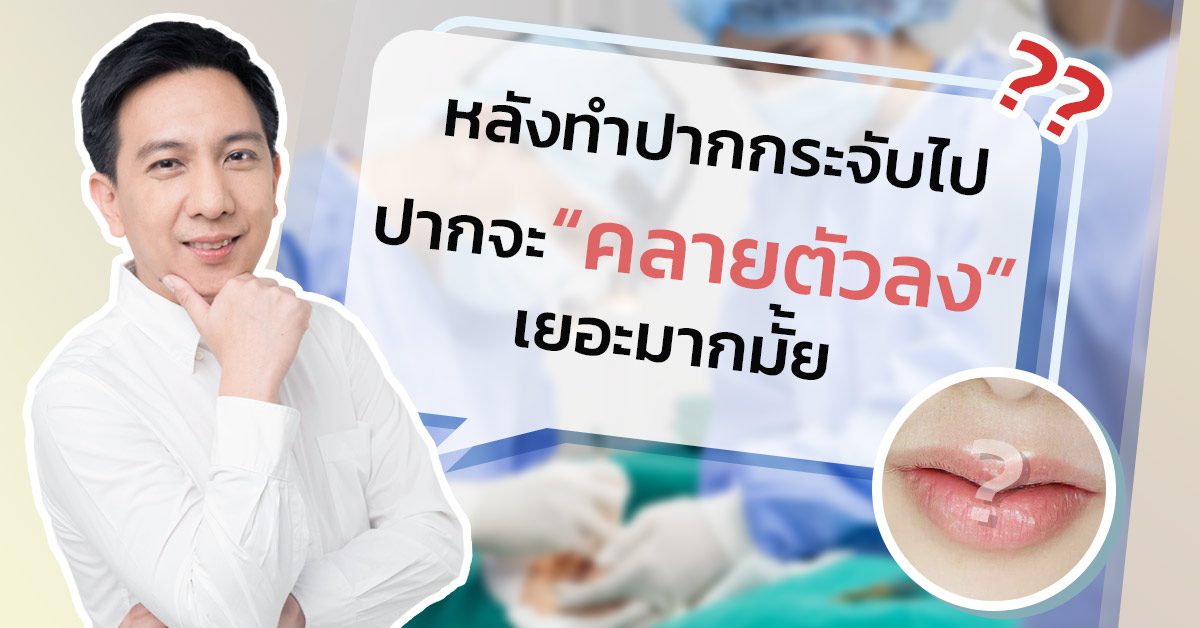 ปากกระจับคลายตัว การคลายตัวของปากกระจับ