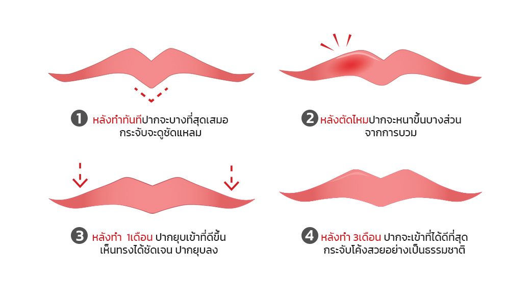 ระยะการคลายตัวของปาก ระยะการคลายตัวของปาก