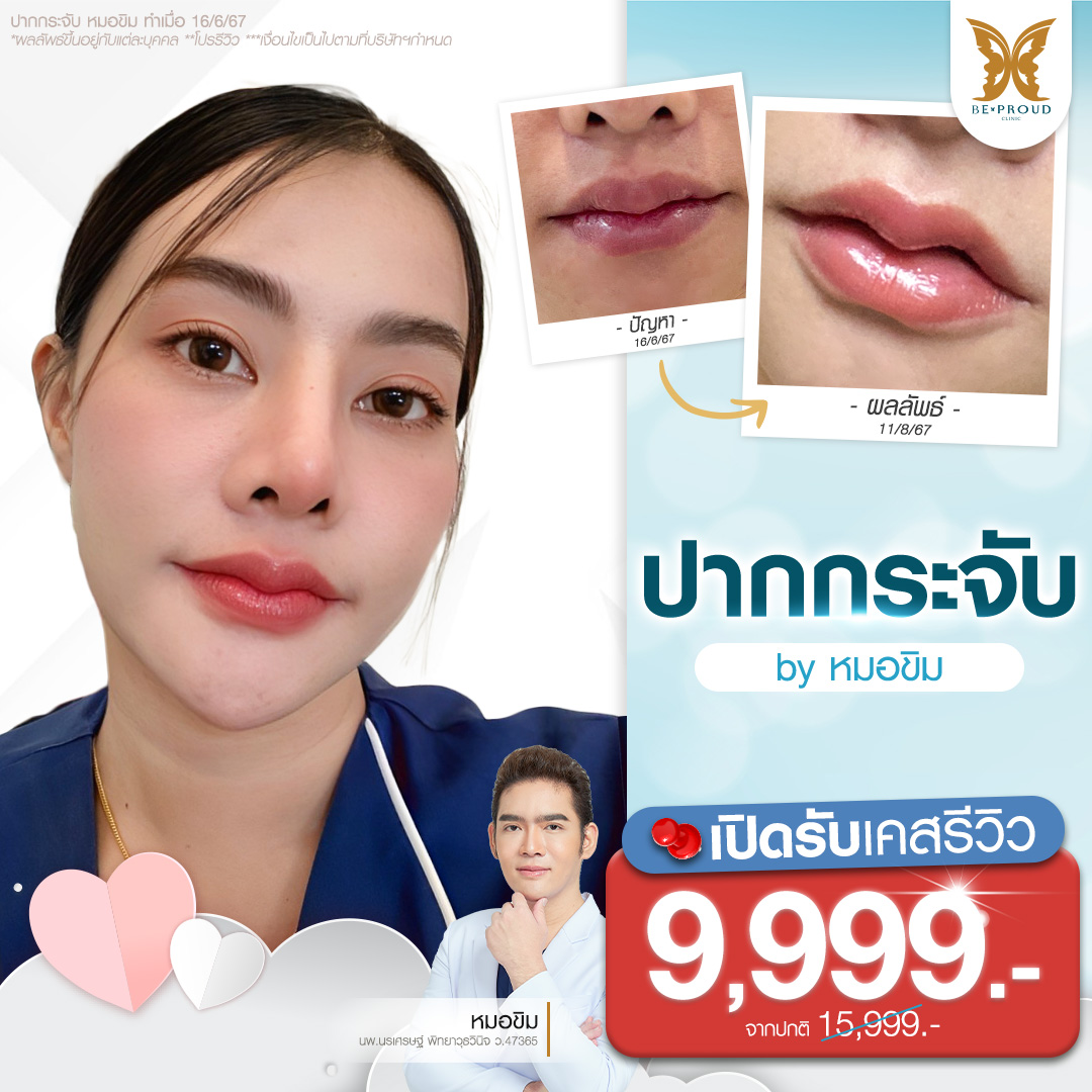 รีวิวปากกระจับ