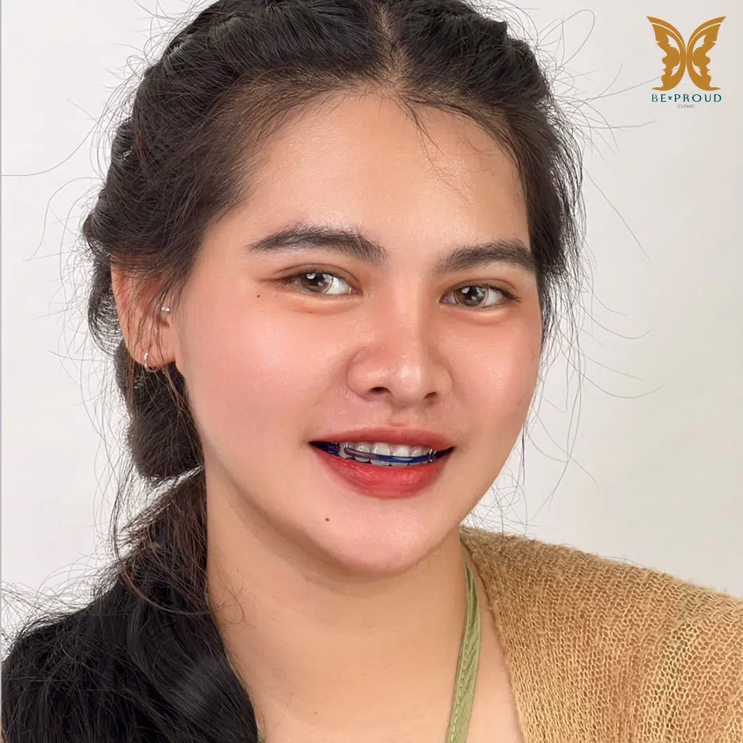 ตาสองขั้น_รีวิว