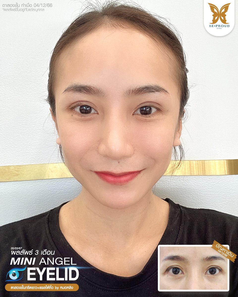 ตาสองขั้น_รีวิว