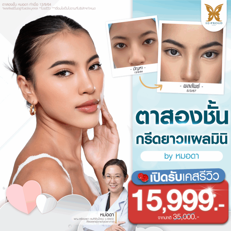 รีวิวตาสองชั้น