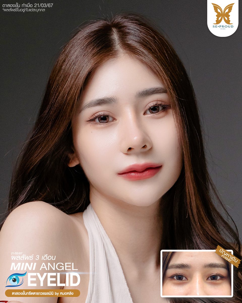 ตาสองขั้น_รีวิว