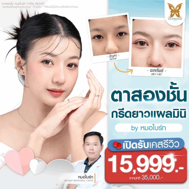 รีวิวตาสองชั้น