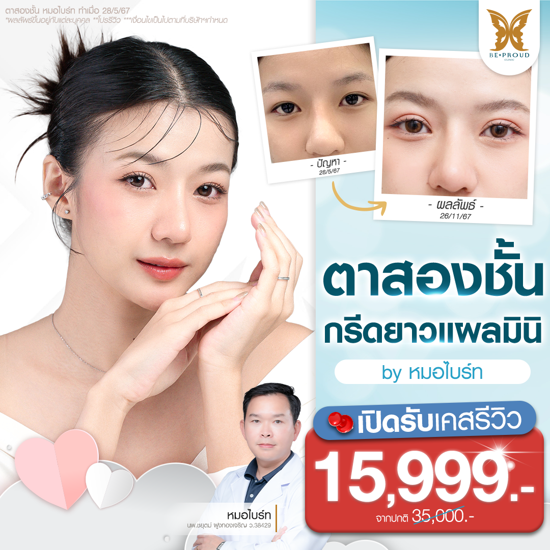 รีวิวตาสองชั้น