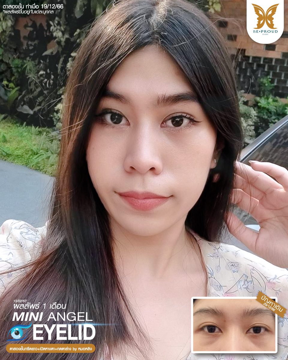 ตาสองขั้น_รีวิว