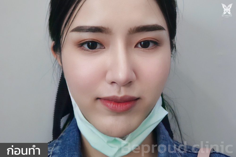 ก่อนทำ