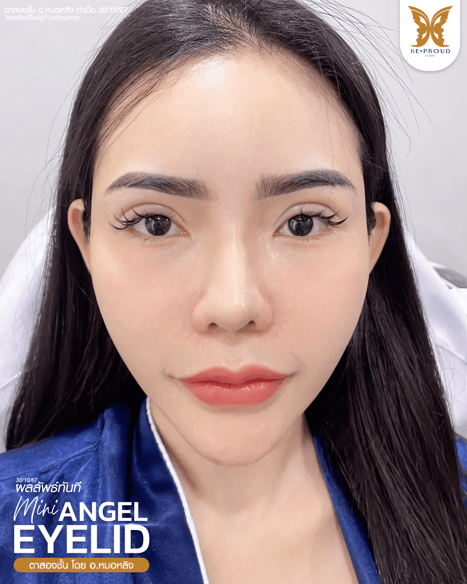 ตาสองขั้น_รีวิว
