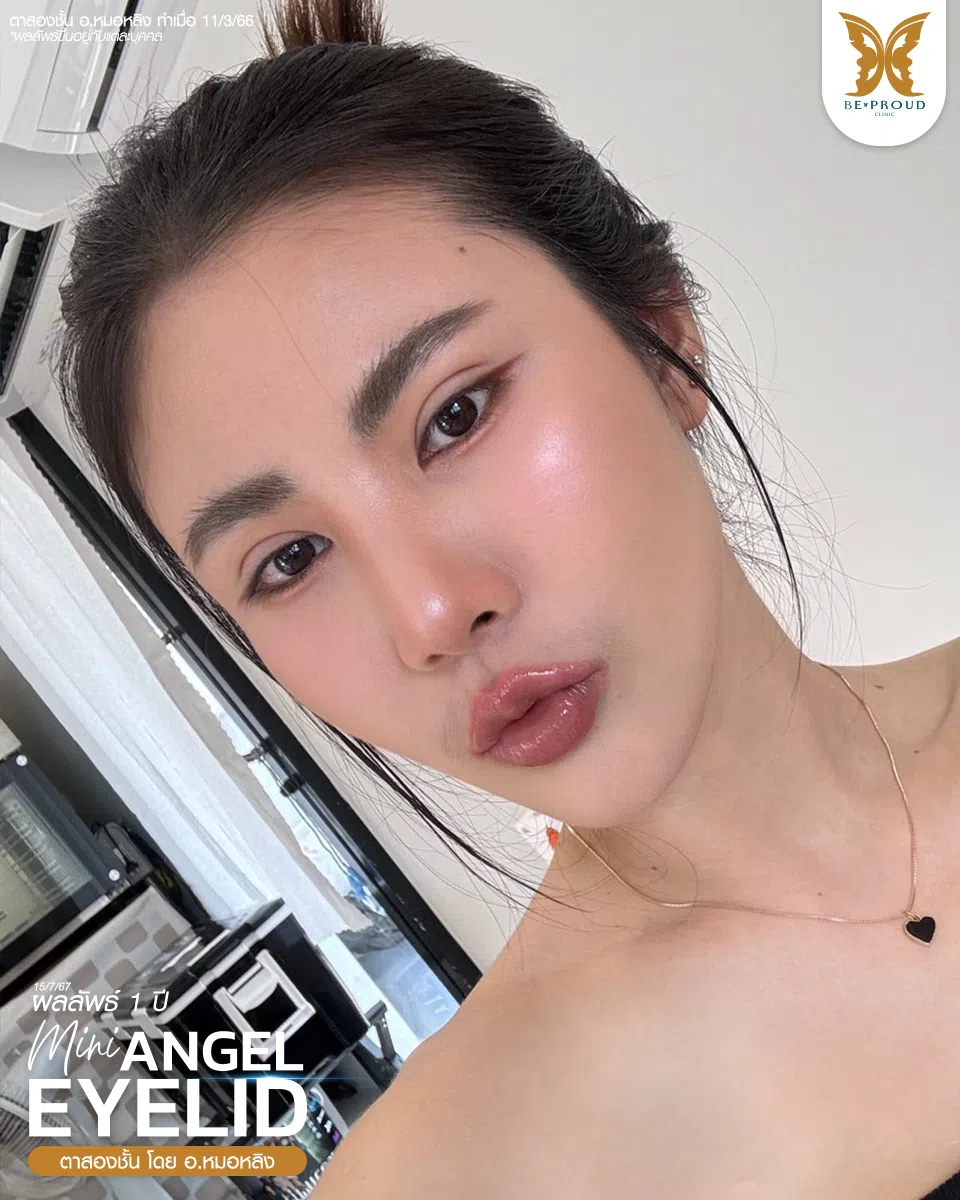 ตาสองขั้น_รีวิว