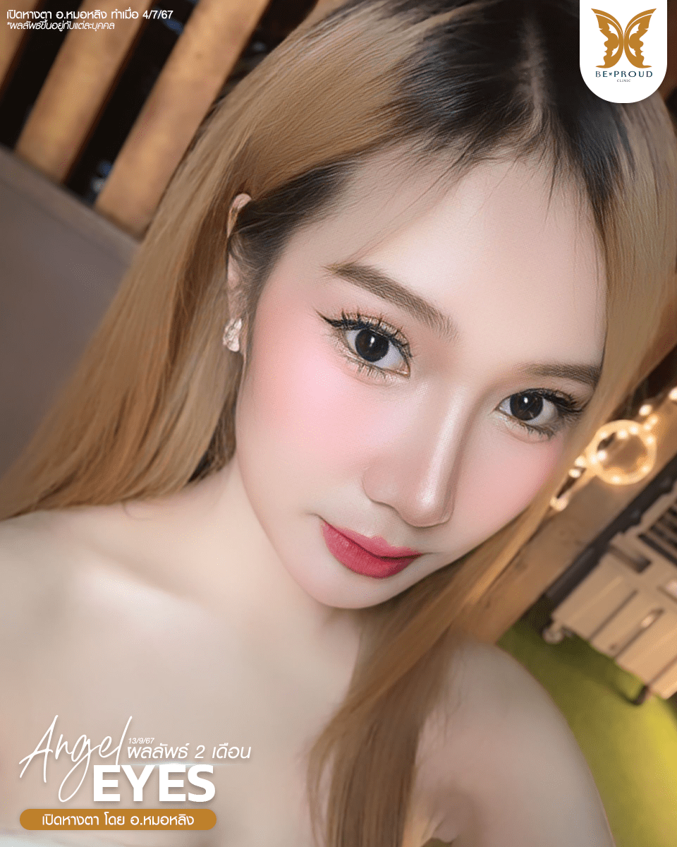 ตาสองขั้น_รีวิว