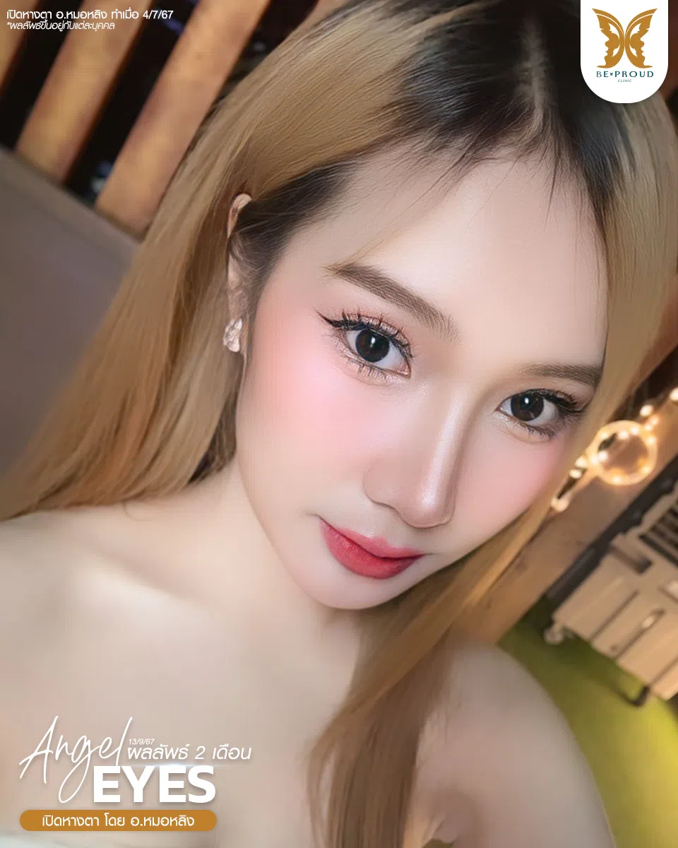 ตาสองขั้น_รีวิว