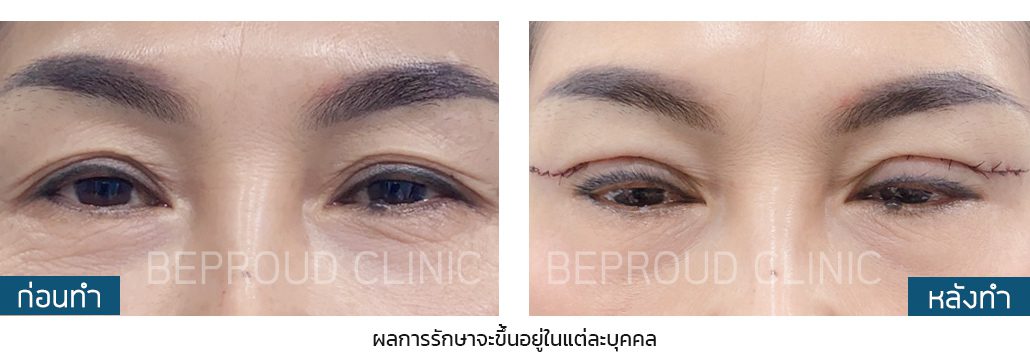 หางหงส์ ผลลัพธ์2 หางหงส์ ผลลัพธ์2