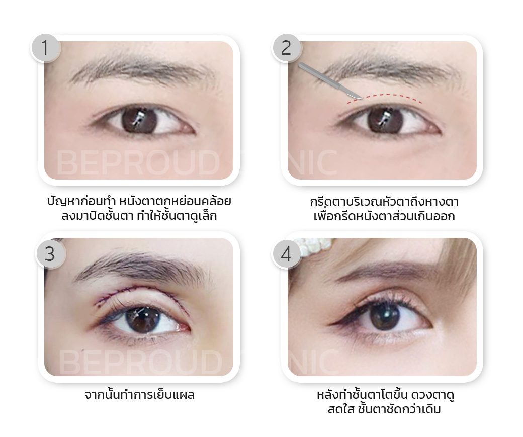 เทคนิค กรีดตายาว เทคนิค กรีดตายาว