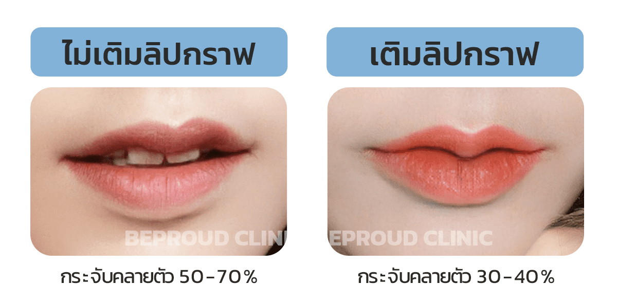 เติมลิปกราฟ-แก้ เติมลิปกราฟ