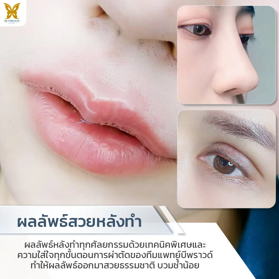 gallery-item