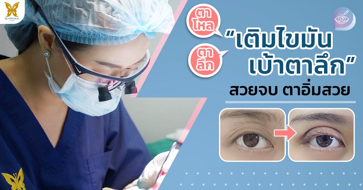 เติมไขมันเบ้าตาลึก เติมไขมันเบ้าตาลึก