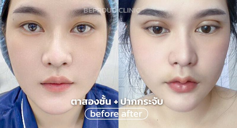 ทำตากับปาก ทำตากับปาก