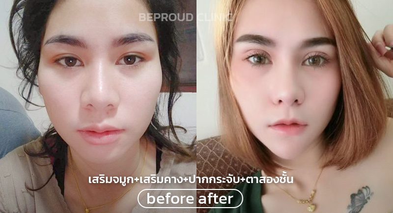 ปากจมูกคางตา ปากจมูกคางตา