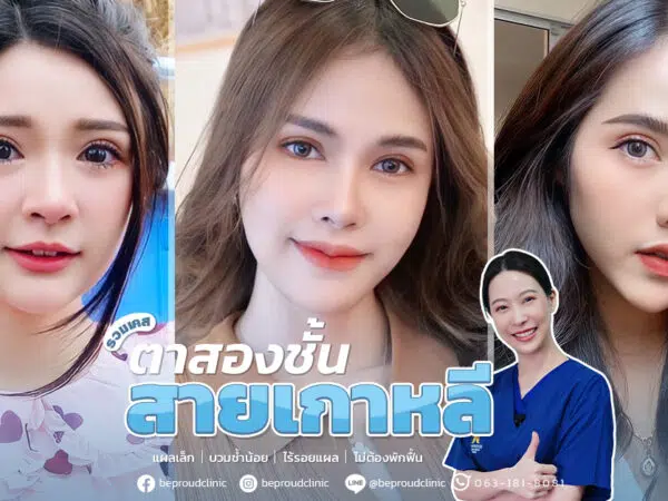 ตาสองชั้น_ตาสองชั้นสายเกาหลี_หมอหลิง