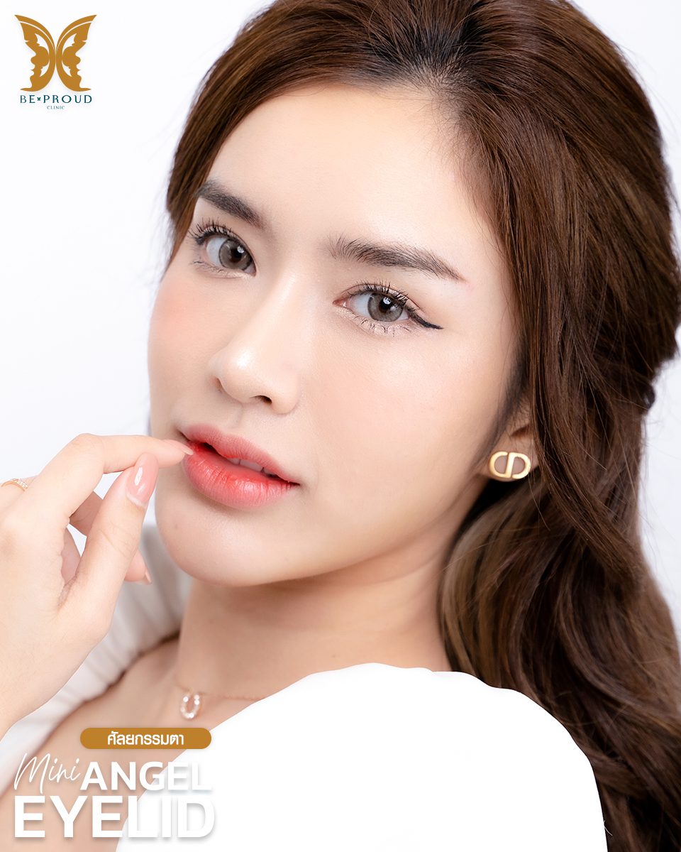 รีวืวตาสองชั้น(1) รีวืวตาสองชั้น(1)