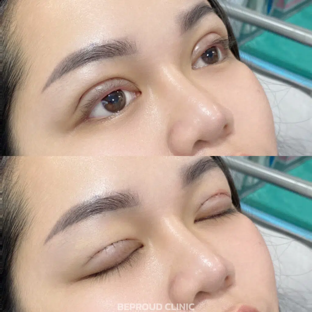 เทคนิคกรีดตายาว ตาสองชั้นหลบใน